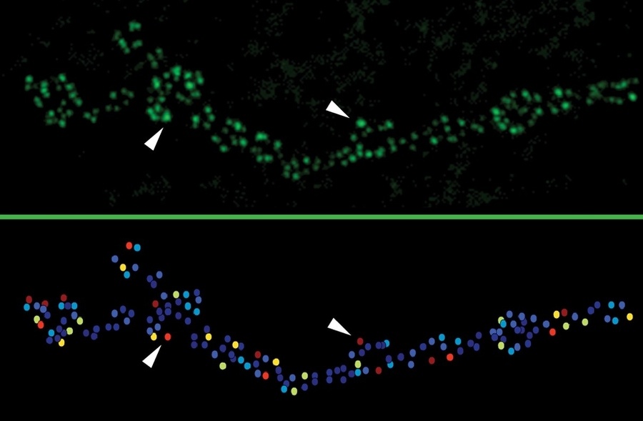 brain, synapses, weak connections, memorization
