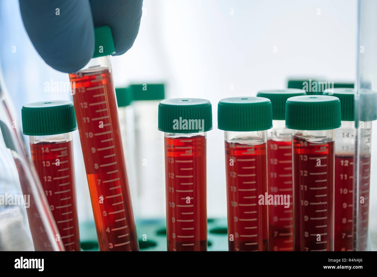 blood test, vials, laboratory setting