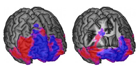 human brain,critical thinking,analysis,decision making