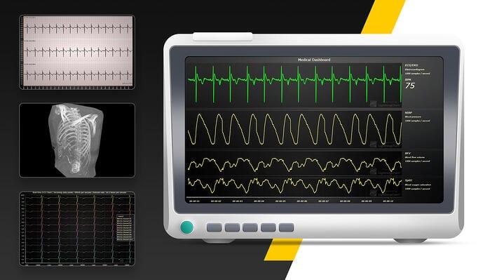 Data visualization dashboard, smartwatch data, health trends