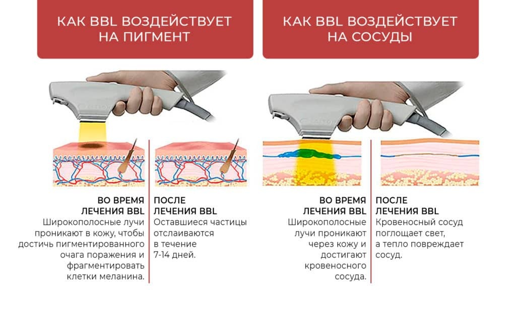 человек,стоит,лазер,попадает в цель,но боится