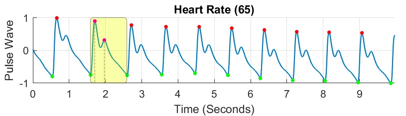 heart,pulse,smartwatch,graph