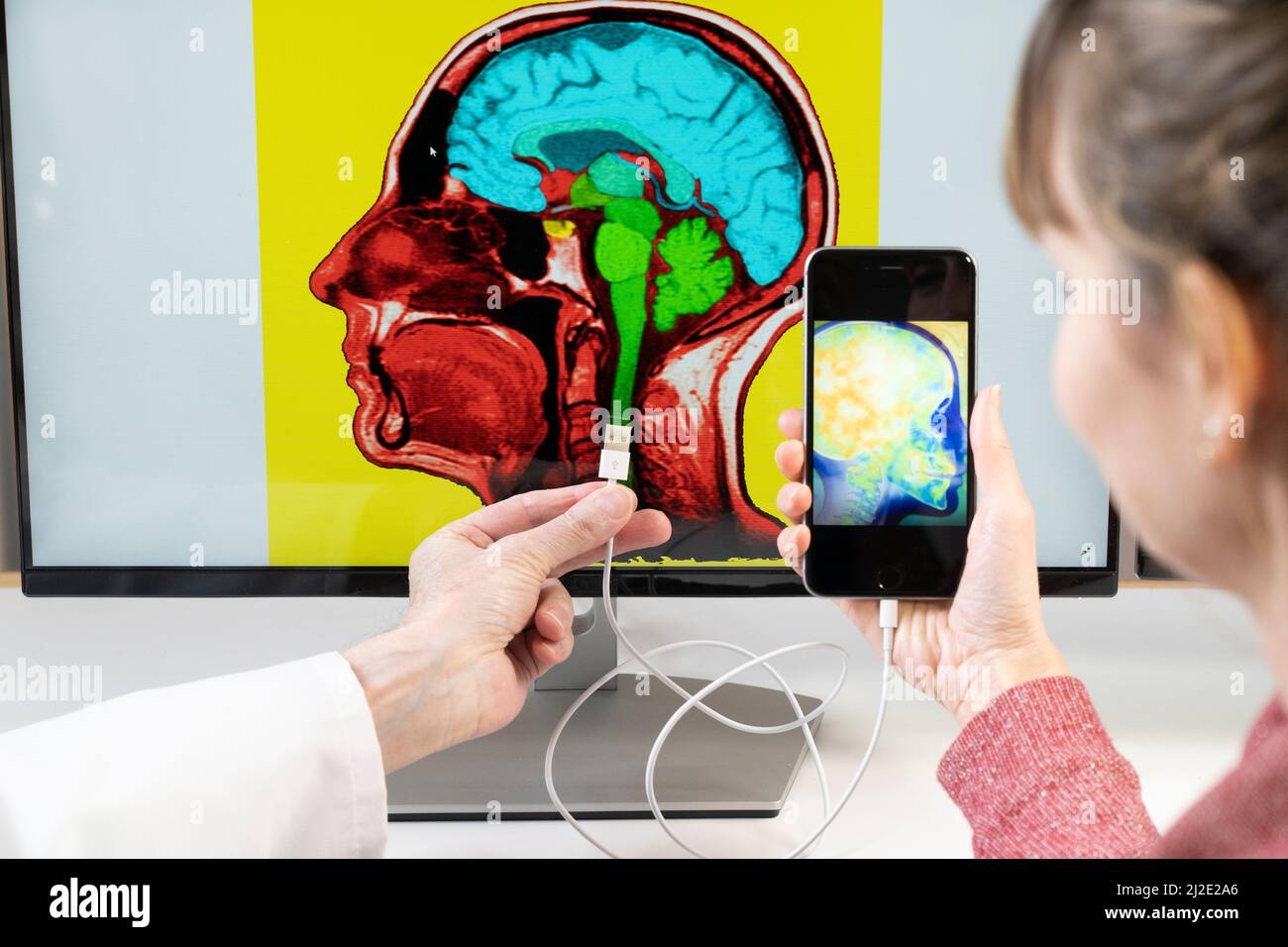 smartwatch,neurointerface,brain,sensor