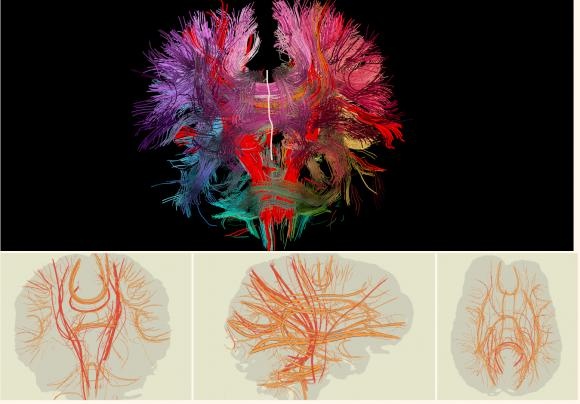 brain,neurons,connections,growth